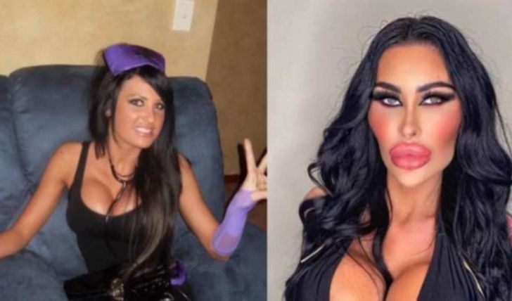 Learn About Tara Jayne's Plastic Surgery: All the Details Here